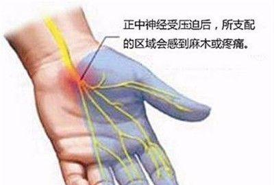 解读：什么是“放射性疼痛”？腰背放射痛该怎么办？
