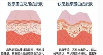 女人怎样补充胶原蛋白？这三点要记住了否则....