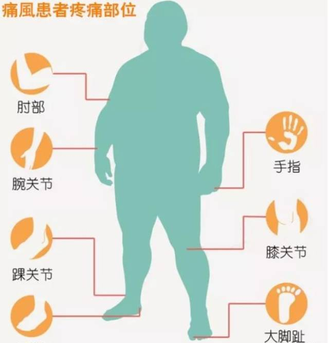 12岁小男孩患上痛风！罪魁祸首竟是如此常见……