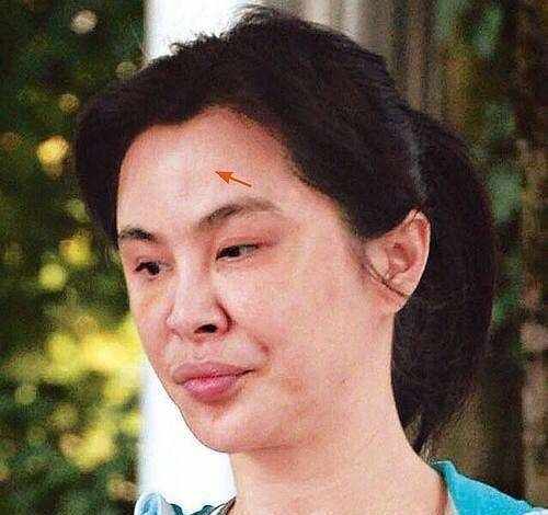 王祖贤出过一次车祸，可以查查，要不不会变化那么多？