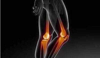 膝盖骨质增生的症状有哪些，需要怎么处理？