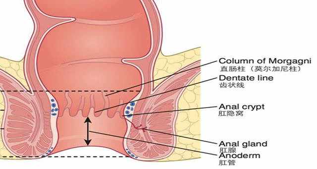 究竟什么是痔疮，得了痔疮又该怎么办呢？
