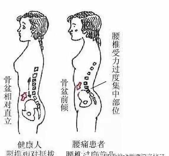 仰卧起坐的正确做法——卷腹