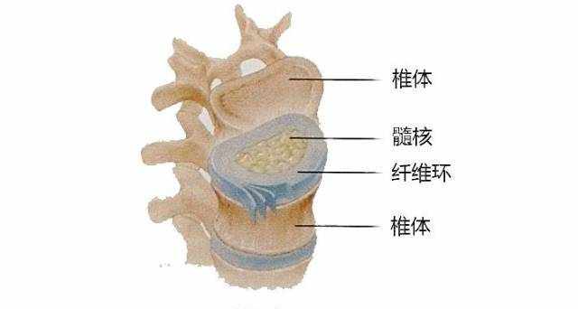 关于腰椎间盘突出，这是我看过最好的科普文 ！
