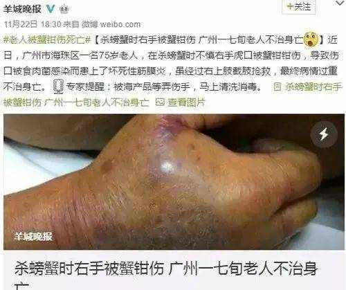 食肉菌”离我们并不遥远，严重时24小时就能“吃掉”感染者！