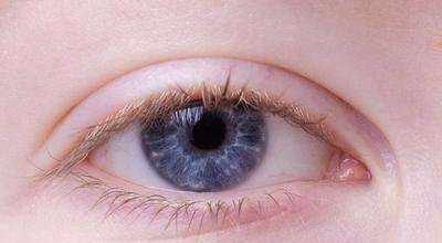 白眼球发蓝暗示贫血严重，眼睛4个症状，你中几个？