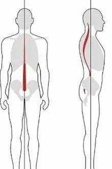 「脊柱侧弯」有多恐怖你知道吗？该如何矫正