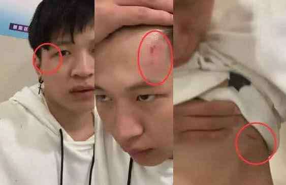 杨清柠直播被王乐乐打 快手王乐乐被郭聪明暴打，杨清柠之后的举动，让粉丝太失望了！