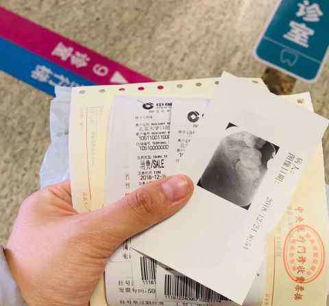 北大口腔医院价格表 一年去了17次北大口腔医院的我，想告诉你的……