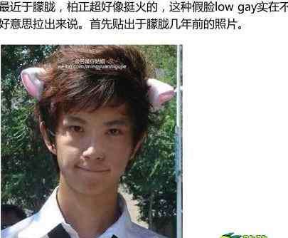 于朦胧整容前后照片 于朦胧是GAY 于朦胧整容前后对比照