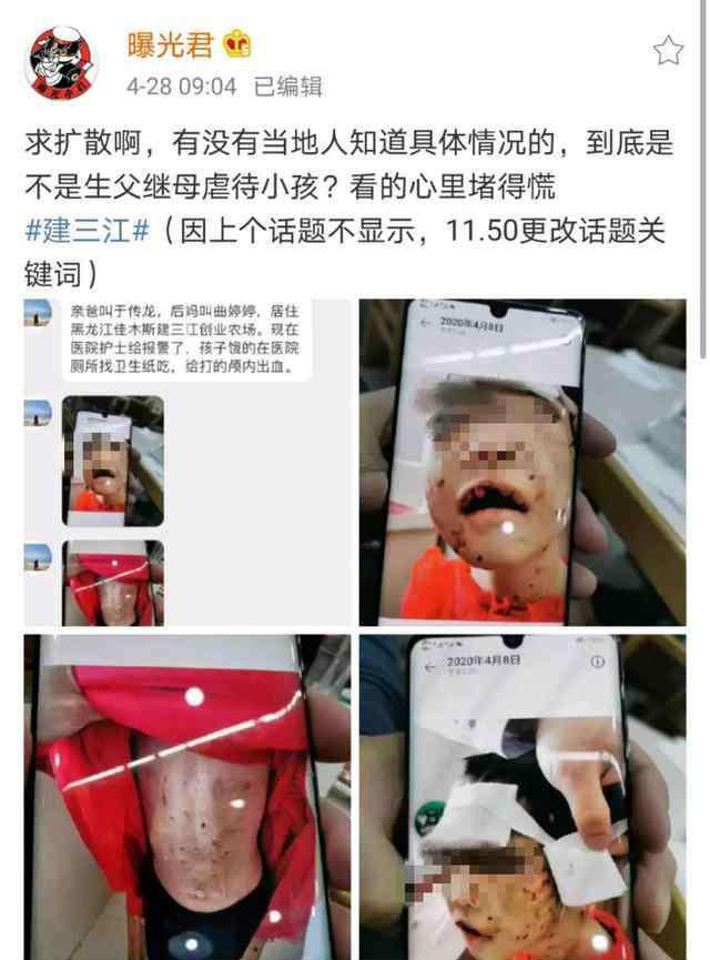 黑龙江女孩 黑龙江被虐打女童有生命危险仍昏迷 其父亲已被刑拘