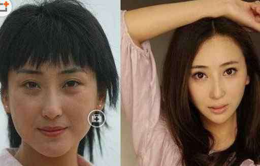 马渼凯的老婆整容前后 严宽老婆杜晓婷整容前后照片对比