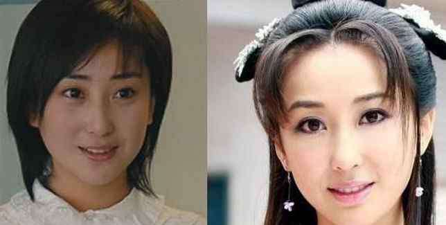 马渼凯的老婆整容前后 严宽老婆杜晓婷整容前后照片对比