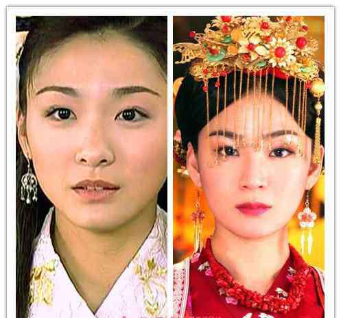 洪小玲微博 洪小玲整容前图片 洪小玲整容前后对比图