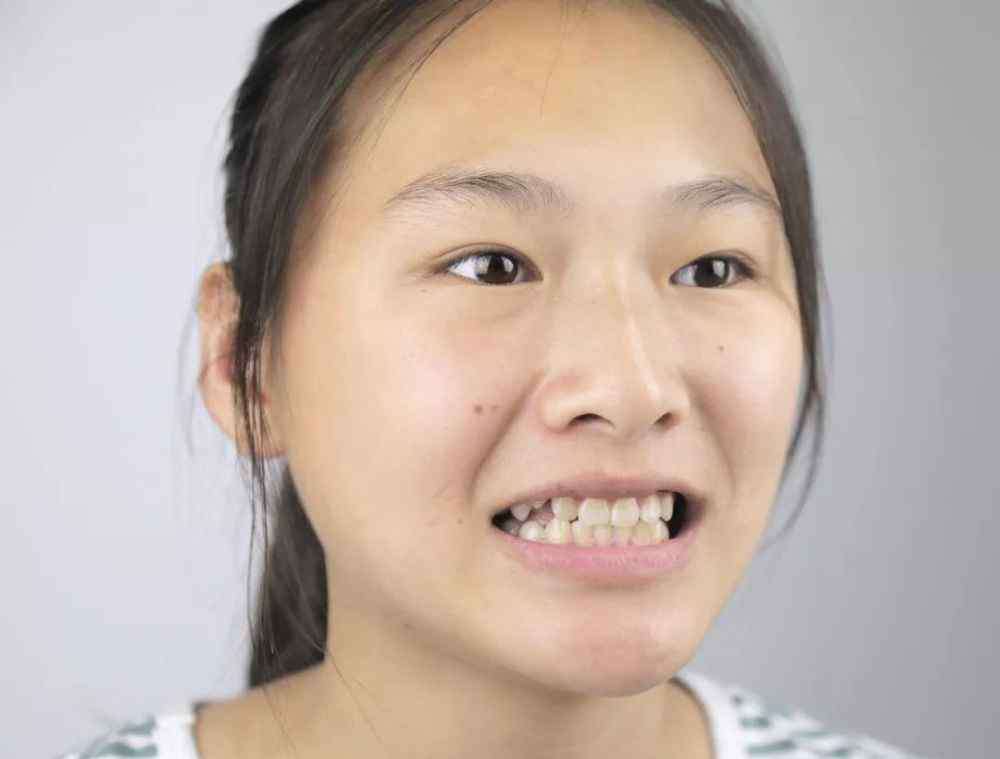 巴普洛夫医科大学 你口臭，是因为胃里有这个东西……