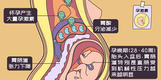 甘肃痔疮东大专业 孕妈的苦楚，甘肃东大肛肠医院替你解忧