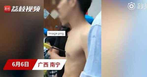 弩箭 细思极恐 小伙玩弩箭射中了自己心口 仅离心脏1厘米！