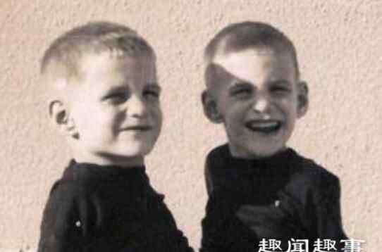 连体兄弟 连体兄弟共同生活68年去世 生前画面曝光令人惊叹