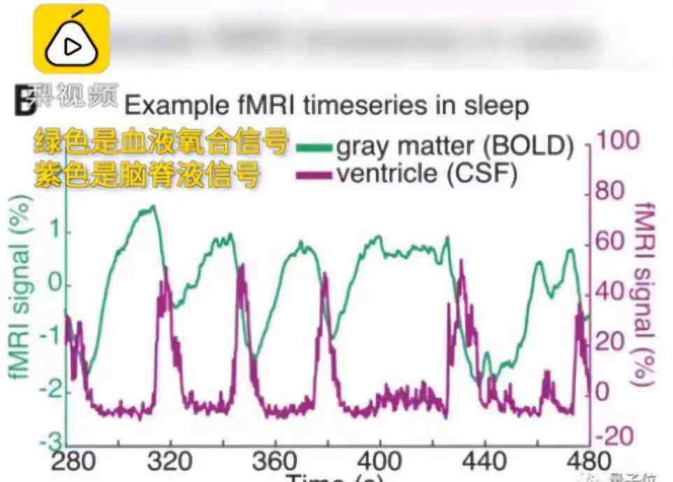 狠狠干狠狠日手机版 “熬夜变笨”终于被科学证实：你的身体正狠狠报复你