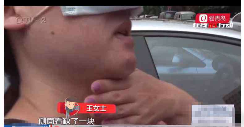 武汉女子医院还咨都巿 青岛华韩整形美容医院整形失败还动手打人？女子：走法律途径维权