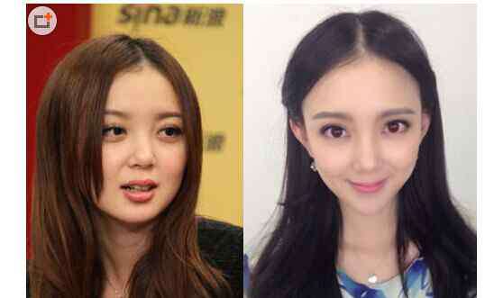 汪小敏图片 汪小敏整容了吗 汪小敏整容前后照片