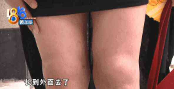 义乌整形 多人反馈在义乌慕莎整形医院整形后不满意：猪鼻子、腿整歪了都有