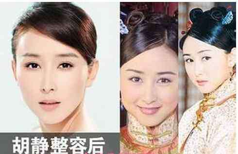 胡静照片 胡静整容了吗 胡静整容前后照片对比照片