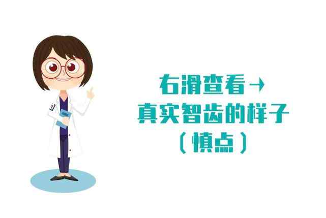 长四颗智齿的概率 关于智齿，你可能不太了解的7个问题