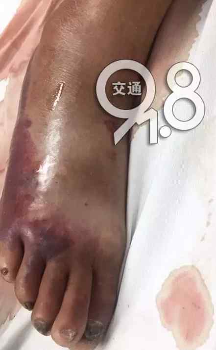 抢救室 昨晚杭州8人几乎同时送进抢救室 是什么原因？