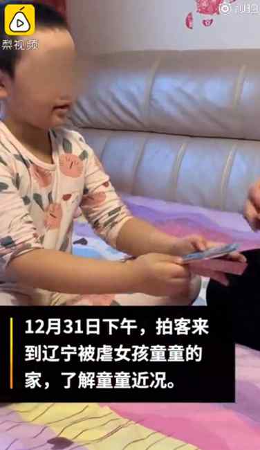 辽宁6岁被虐女童现状恢复良好 头发种植成功 网友：放心了！