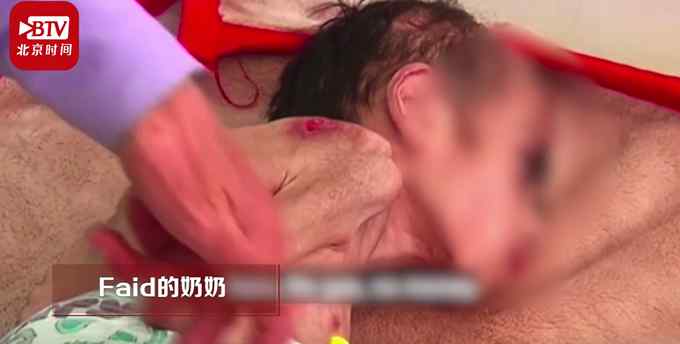 也门一7岁男孩体重仅7公斤 不敢多看一眼！网友哭了