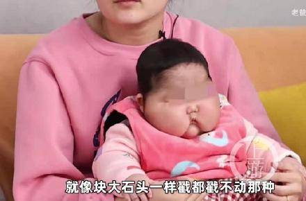 5月大婴儿用抑菌霜后成大头娃娃 到底怎么一回事 始末回顾