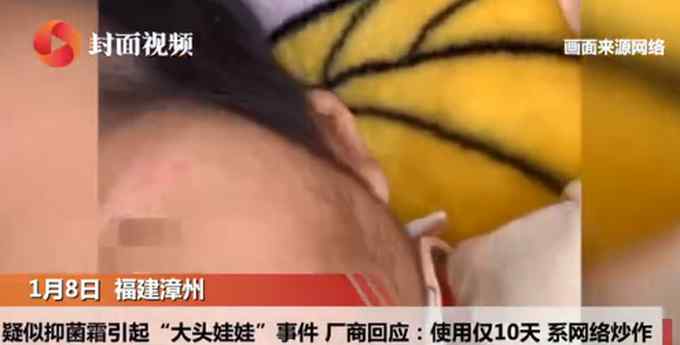 官方通报“婴儿用抑菌霜成大头娃娃” 涉事厂商回应  质疑家长网络炒作
