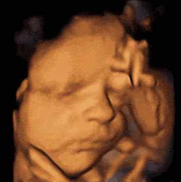 四维彩超对胎儿有影响吗 听说四维彩超辐射大，会对孕妈和胎宝产生伤害？
