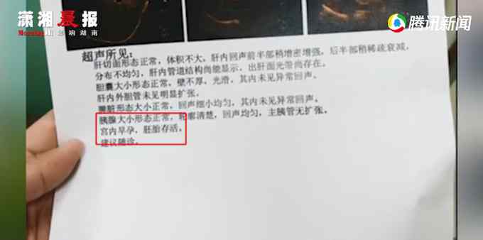 奇葩！广东一男子医院就诊被查出怀孕 自嘲要寻找孩子父亲 医院回应亮了