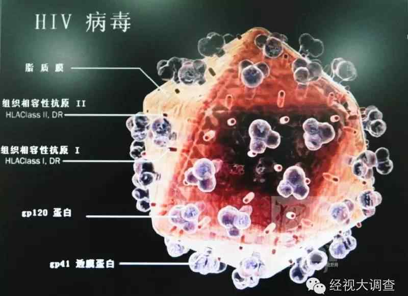 老人输血感染艾滋 七旬老太疑因输血感染艾滋病即将开庭