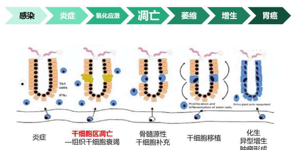 胃萎缩能治好吗 萎缩性胃炎，是胃缩小了么？一定会癌变吗？能治好吗？