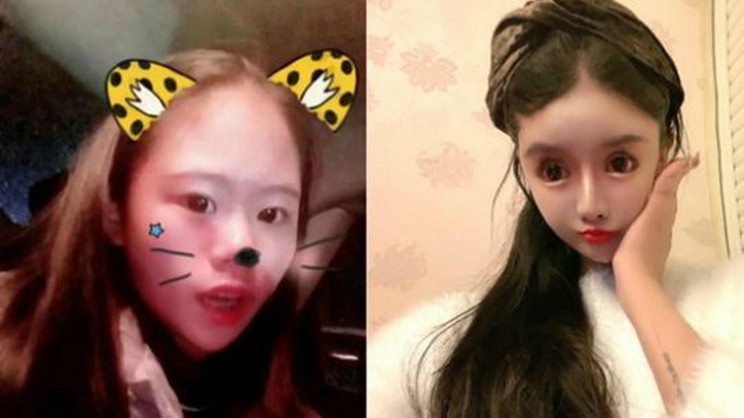 “接受变美的代价 别学我！” 00后学生整容上百次 前后对比照曝光