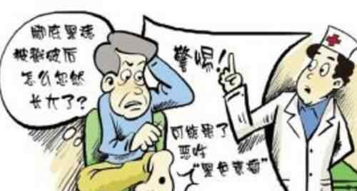 黑痣癌变的征兆图片 脸上长了28年的痣癌变 原因竟是女儿经常摸