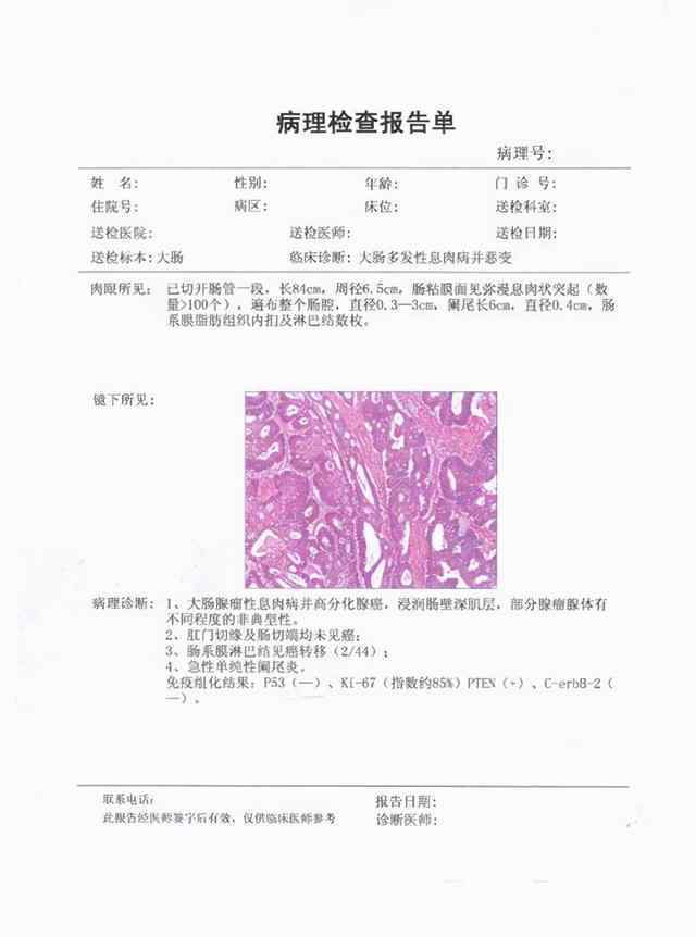 病理检查 已经临床诊断为癌症了，为什么还要做病理活检？是不是过度检查