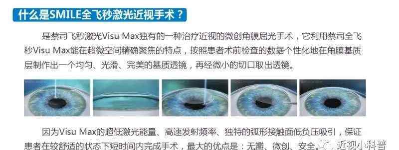 全飞秒多少度可以做 关于全飞秒价格的那些事！你知道吗？