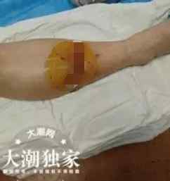 陆丽珠 女子旅游时从台阶上摔下 热心警察背着她走