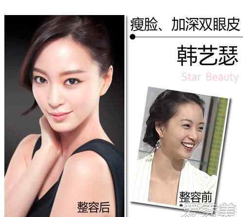 崔智友整容 韩女星整容前旧照曝光 崔智友眼小鼻塌