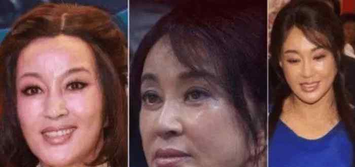 王心凌整容 被玻尿酸毁了的六大女星，王心凌像老太太，而她丑到不能接受