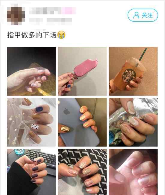 萧山一姑娘频繁美甲 指甲“受了伤” 专业医生教你正确护甲