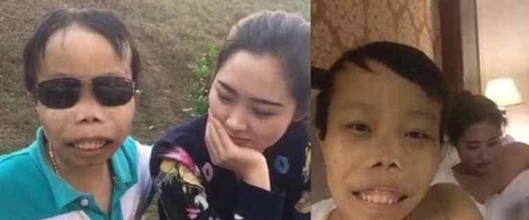 yy外星人陈山 史上最丑富二代陈山 外星人陈山与女友床照流出