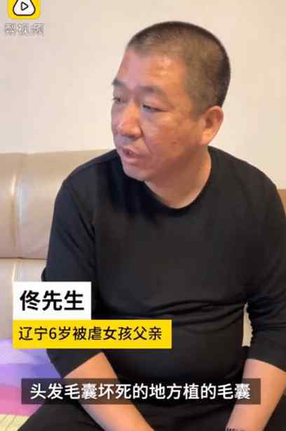 河南头发种植 辽宁6岁被虐女童现状恢复良好，头发种植成功，网友：放心了！