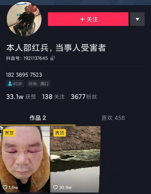 河南男子匿名举报工厂污染被打伤 涉事肠衣公司被封 官方查泄密“内鬼”