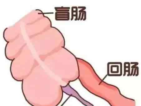 阑尾炎症状疼痛位置图 注意！这三大症状，小心是阑尾炎发出“预警”