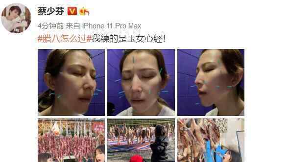 在照片上扎针害人 蔡少芬晒照“练玉女心经”，脸上和头上扎针有点吓人，而张晋“扎心了”